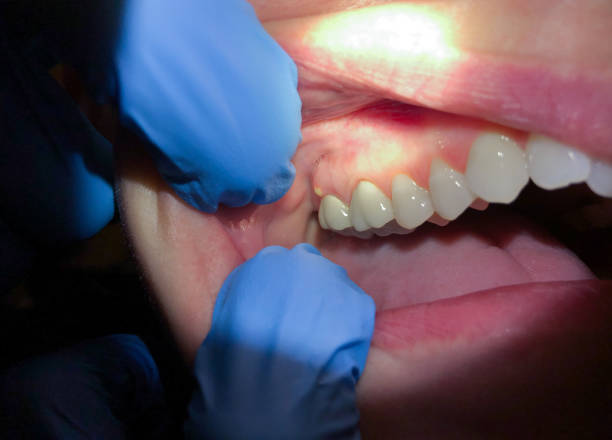 Best Urgent Dental Care in Dover Beaches South, NJ